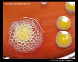 positive catalase test with a colony of s.aureus on blood agar